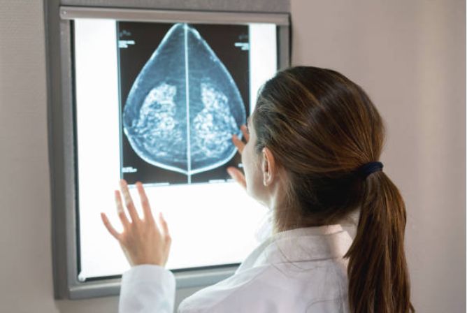 Mammography in chandigarh