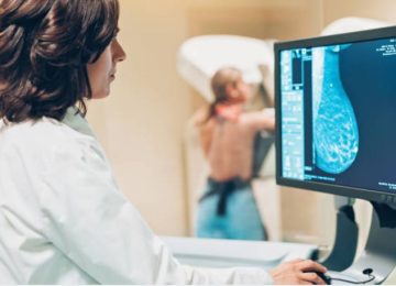 mammography in chandigarh