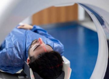 pet scan in chandigarh
